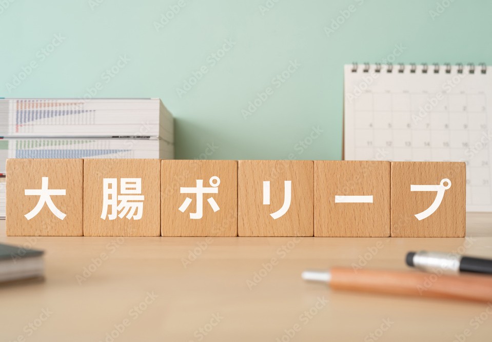 医療コラム第5回:大腸ポリープが見つかったらどうする?──治療と再発予防のポイント