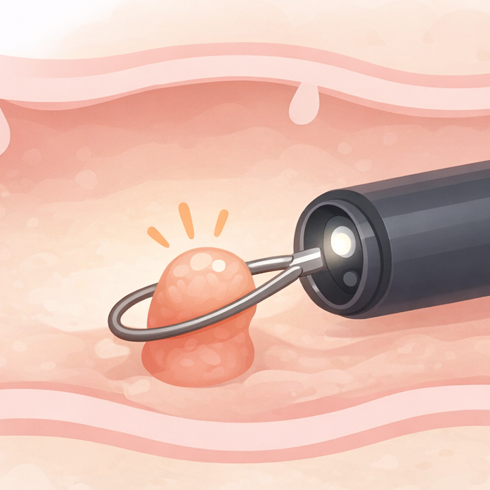 大腸ポリープが見つかったら？｜治療と再発予防のポイント【医療コラム第5回】