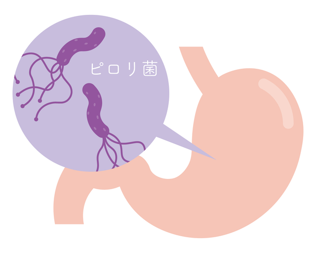 医療コラム第25回：健診で「ピロリ菌」と言われたら？
