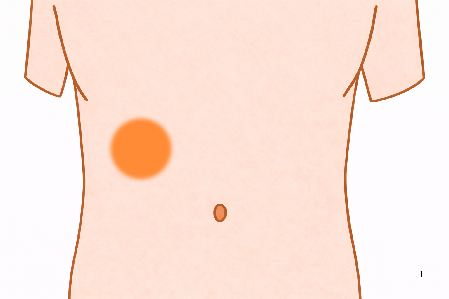 右上腹部が痛い原因とは?|胆石・肝臓・胆のうの病気【医療コラム第79回】