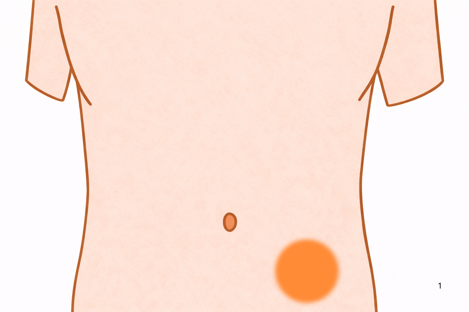 左下腹部が痛い原因とは?|大腸の病気と検査の目安【医療コラム第78回】