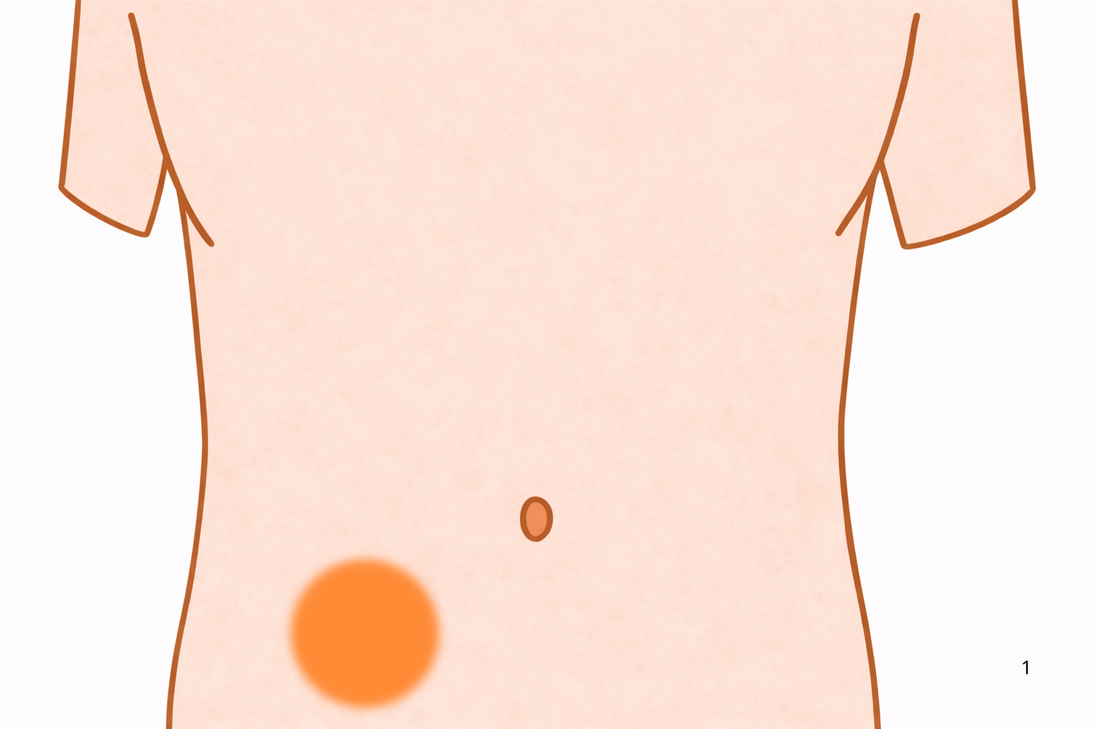 右下腹部が痛い|虫垂炎・腸炎・婦人科疾患の可能性【医療コラム第77回】