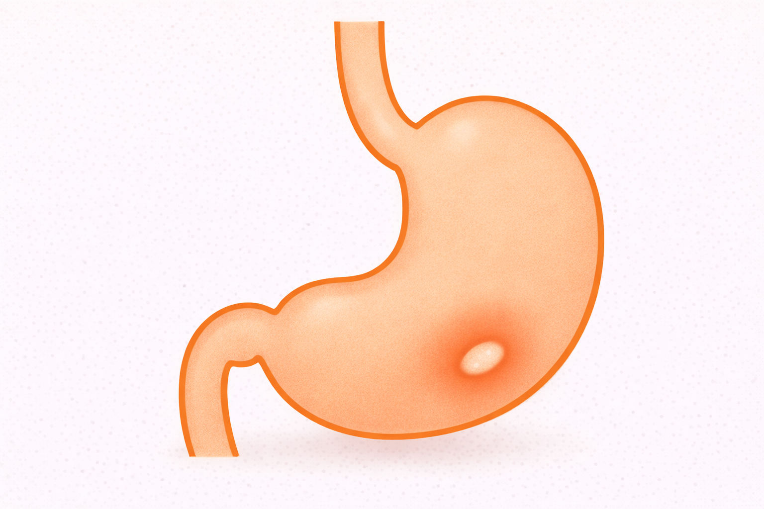 胃潰瘍とは？｜みぞおちの痛み・黒い便の原因と受診の目安【医療コラム第89回】