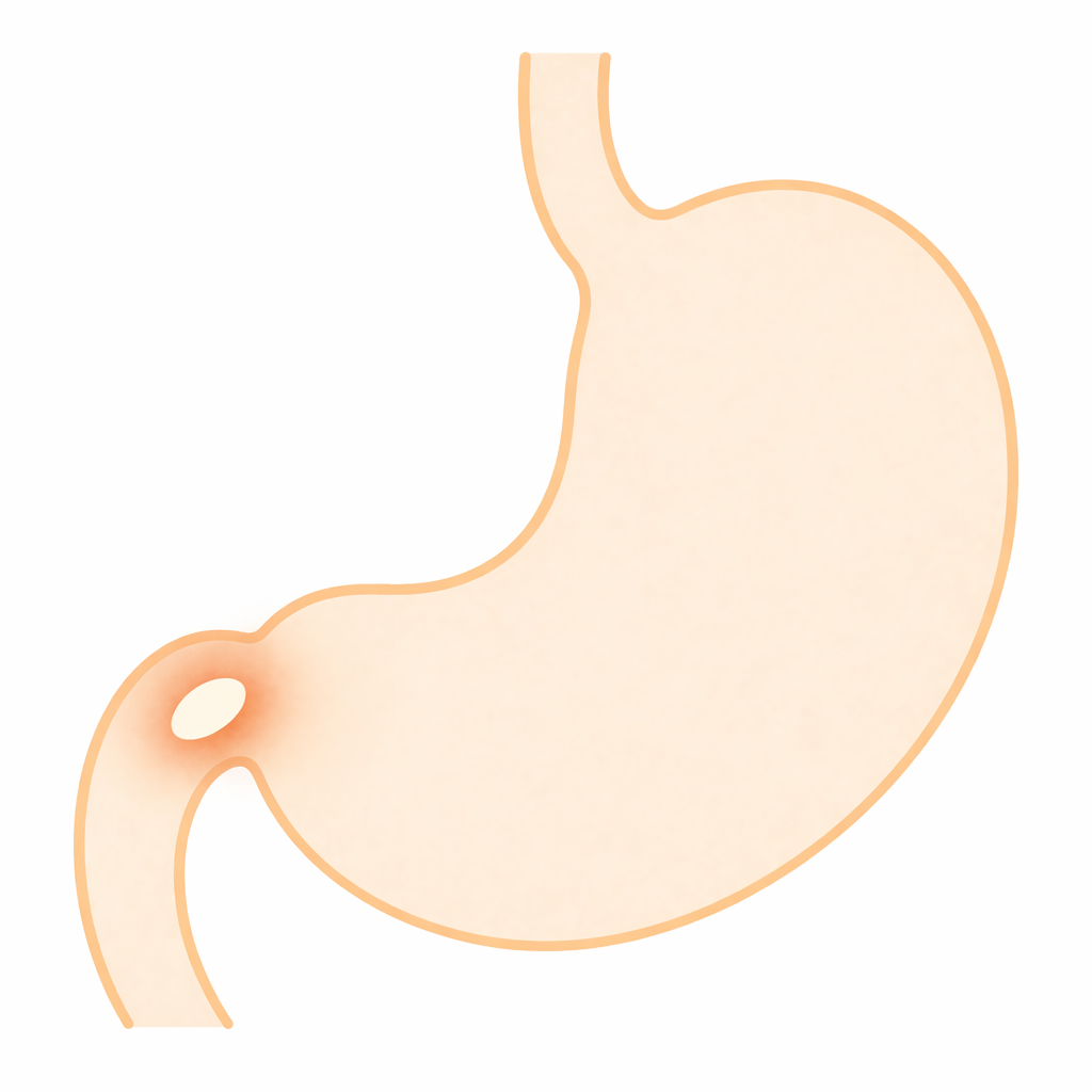 十二指腸潰瘍とは？｜空腹時の胃痛の原因と受診の目安【医療コラム第90回】