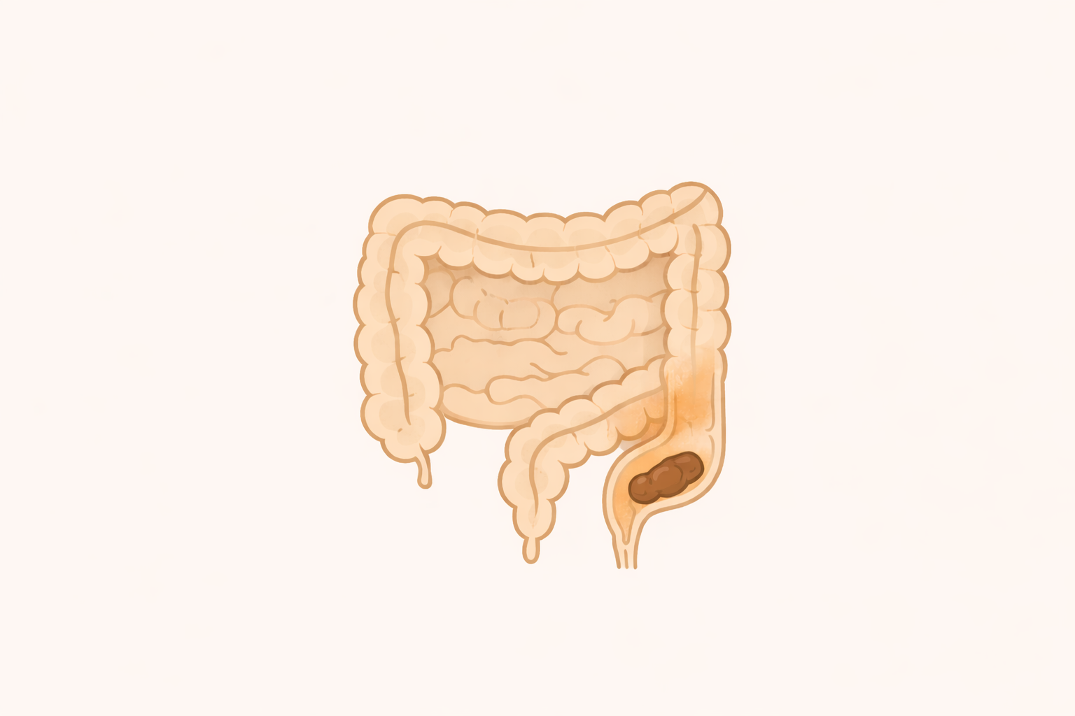 残便感が続く原因とは?|大腸の病気と検査の目安【医療コラム第81回】