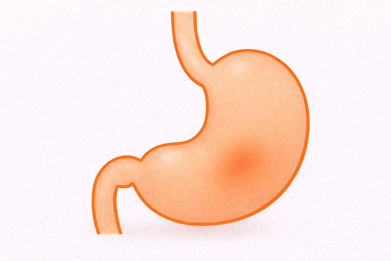 胃がんの初期症状とは？｜見逃しやすいサインと早期発見の大切さ【医療コラム第91回】