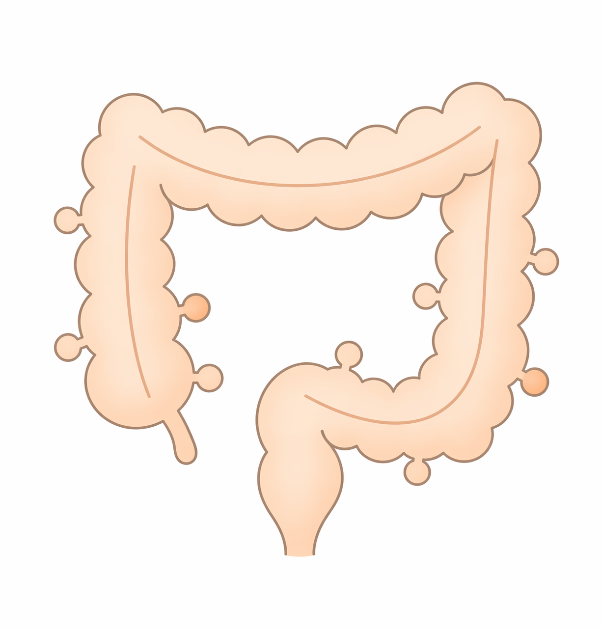 大腸憩室とは？｜腹痛・出血の原因になることもある病気を解説【医療コラム第101回】